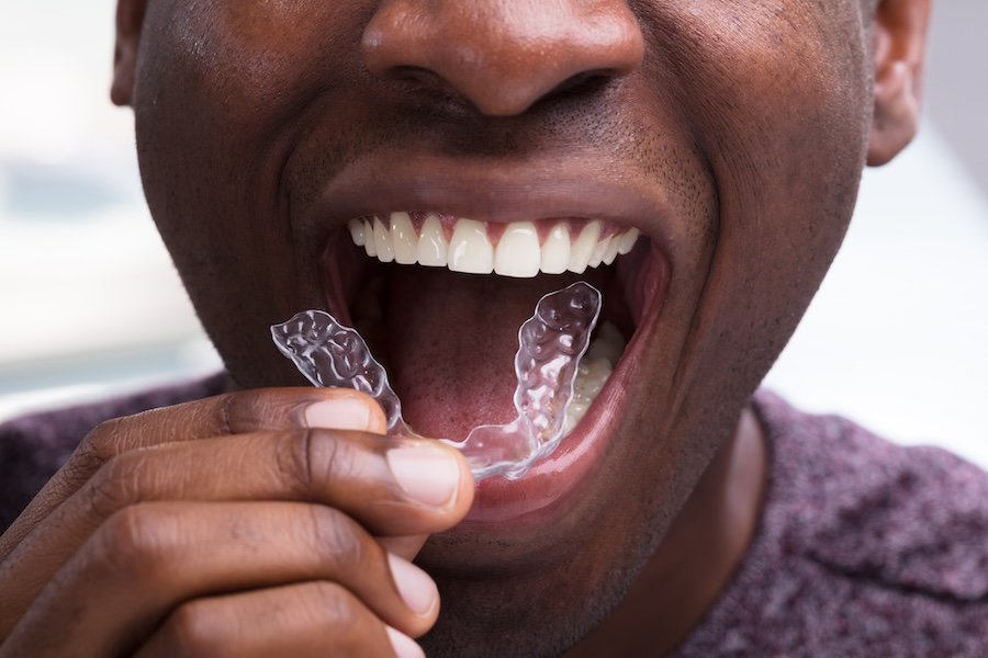 caring for clear aligners, Invisalign tips, aligner care, oral hygiene with aligners, Bolt Family Dental, Invisalign treatment, clear aligner maintenance